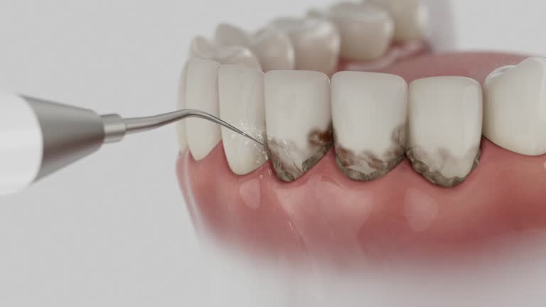 Reliable Invisalign Clear Aligners contractor in Brownfields, LA by Smile Center Dentistry